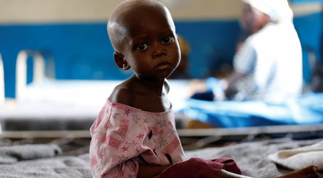 UNICEF: Kongoda 400 bin çocuk açlıktan ölebilir